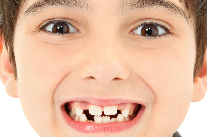 Orthodontic Treatment at Ferring Dental Practice, Dentist